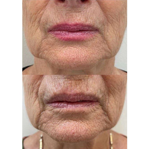 1e5f3bc6-75a1-4016-86ae-ca0d7b482e61