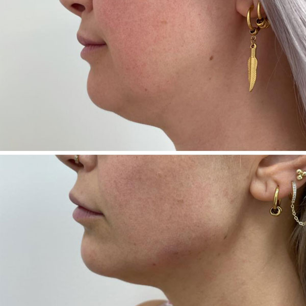 5d72c661-54fd-42cc-993c-d264eef78e04