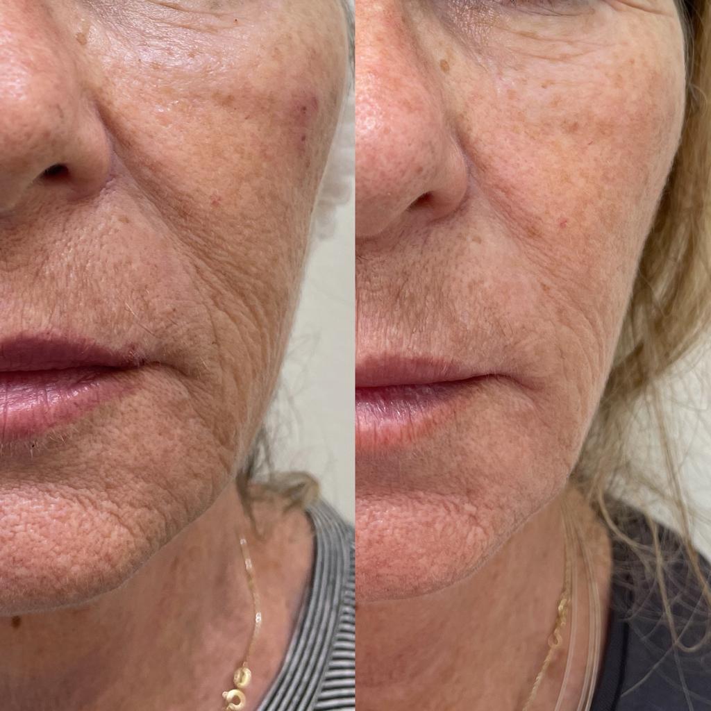 WhatsApp Image 2022-06-22 at 17.25.46